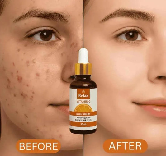 Vitamin C Serum for Brightening & Acne Removal